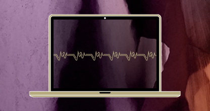 ATTR-CM Survey - Silencers ± Combo Are Likely to Gain at the Expense of Stabilizer Monotherapy